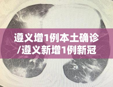 遵义增1例本土确诊/遵义新增1例新冠肺炎 遵义增1例本土确诊/遵义新增1例新冠肺炎