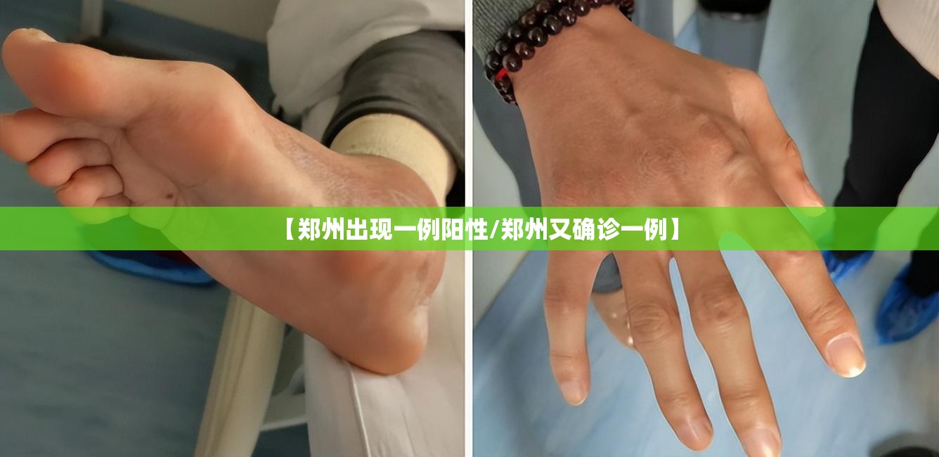 【郑州出现一例阳性/郑州又确诊一例】 【郑州出现一例阳性/郑州又确诊一例】