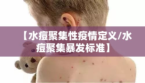 【水痘聚集性疫情定义/水痘聚集暴发标准】 【水痘聚集性疫情定义/水痘聚集暴发标准】