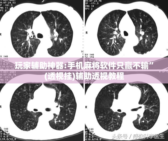 玩家辅助神器:手机麻将软件只赢不输	”(透视挂)辅助透视教程