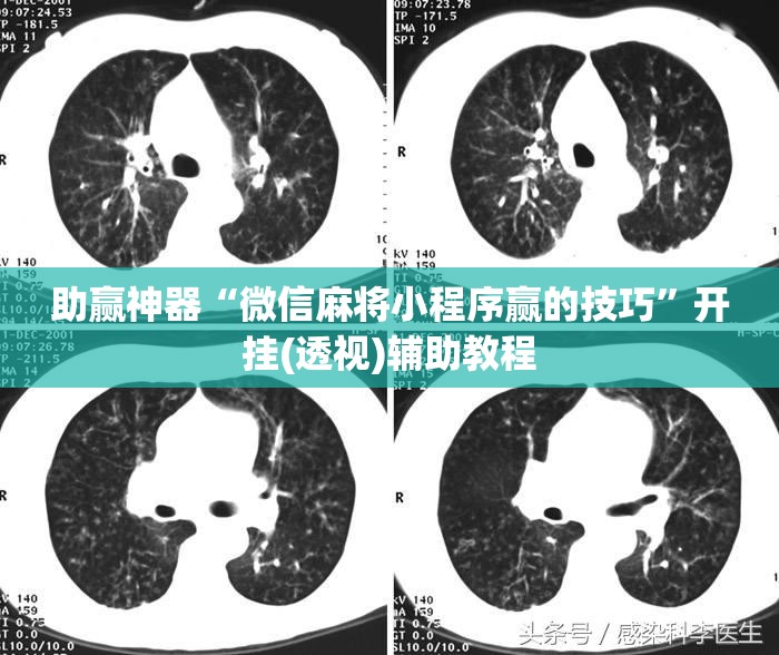 助赢神器“微信麻将小程序赢的技巧	”开挂(透视)辅助教程