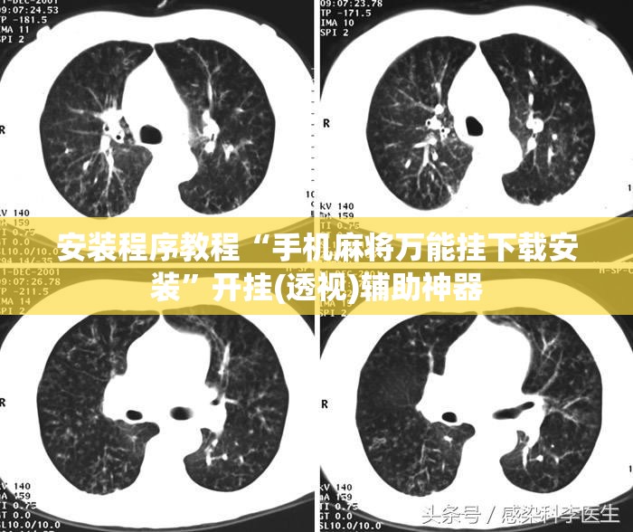安装程序教程“手机麻将万能挂下载安装”开挂(透视)辅助神器