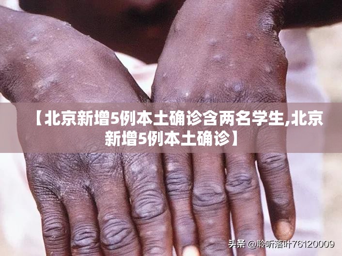 【北京新增5例本土确诊含两名学生,北京新增5例本土确诊】