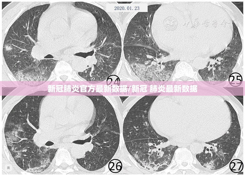新冠肺炎官方最新数据/新冠 肺炎最新数据
