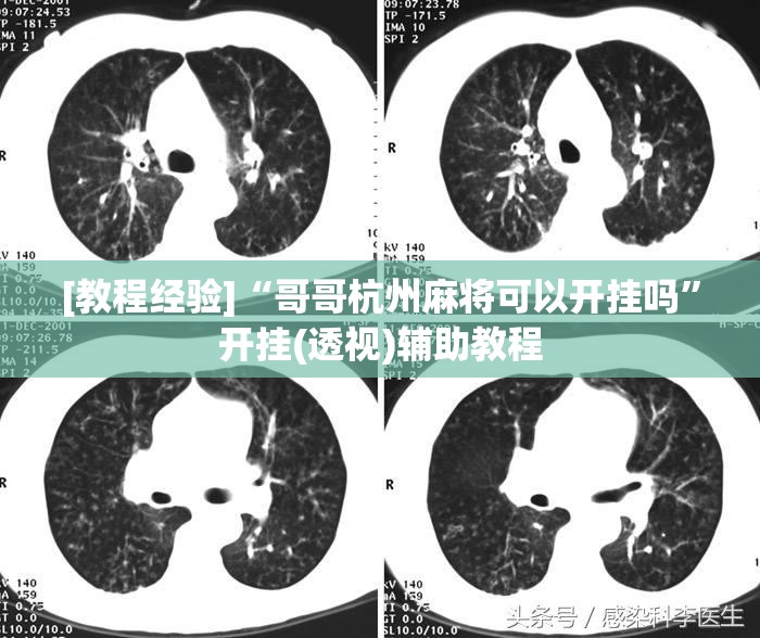 [教程经验]“哥哥杭州麻将可以开挂吗	”开挂(透视)辅助教程