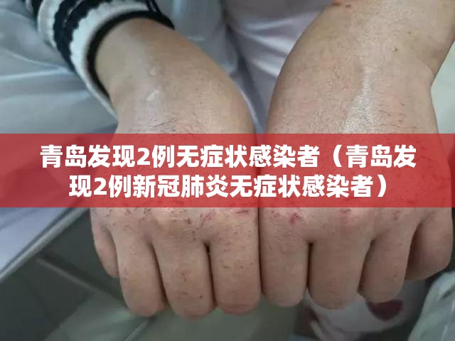 青岛发现2例无症状感染者(青岛发现2例新冠肺炎无症状感染者) 青岛发现2例无症状感染者(青岛发现2例新冠肺炎无症状感染者)
