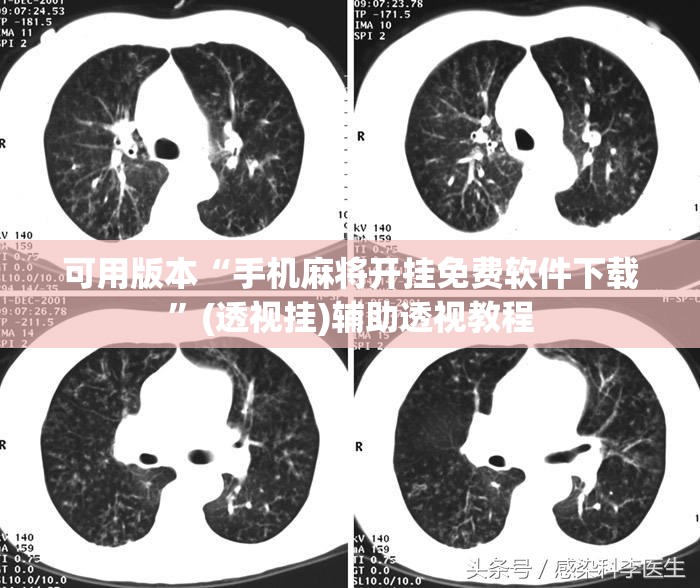 可用版本“手机麻将开挂免费软件下载”(透视挂)辅助透视教程