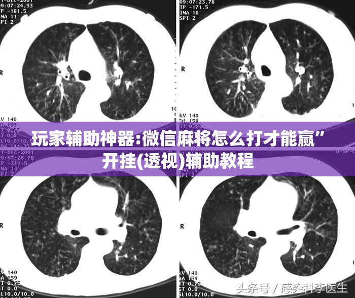 玩家辅助神器:微信麻将怎么打才能赢”开挂(透视)辅助教程