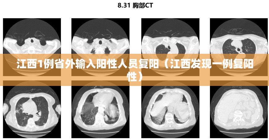 江西1例省外输入阳性人员复阳(江西发现一例复阳性) 江西1例省外输入阳性人员复阳(江西发现一例复阳性)