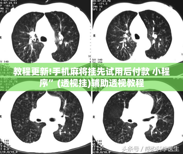 教程更新!手机麻将挂先试用后付款 小程序”(透视挂)辅助透视教程