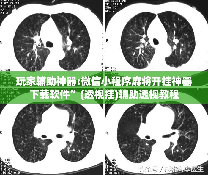 玩家辅助神器:微信小程序麻将开挂神器下载软件	”(透视挂)辅助透视教程