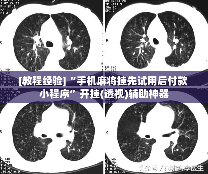 [教程经验]“手机麻将挂先试用后付款 小程序	”开挂(透视)辅助神器