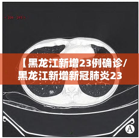 【黑龙江新增23例确诊/黑龙江新增新冠肺炎23例】 【黑龙江新增23例确诊/黑龙江新增新冠肺炎23例】
