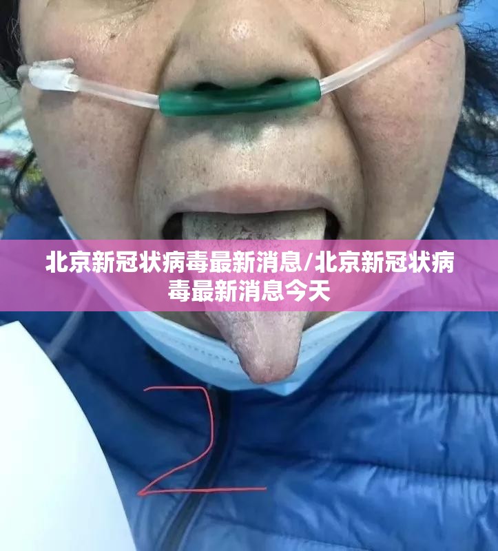 北京新冠状病毒最新消息/北京新冠状病毒最新消息今天