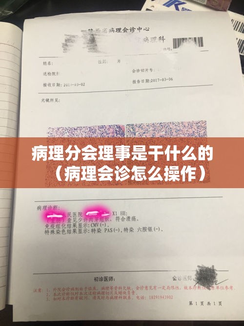 病理分会理事是干什么的(病理会诊怎么操作) 病理分会理事是干什么的(病理会诊怎么操作)