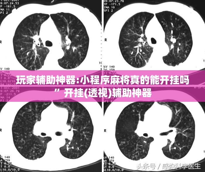 玩家辅助神器:小程序麻将真的能开挂吗	”开挂(透视)辅助神器
