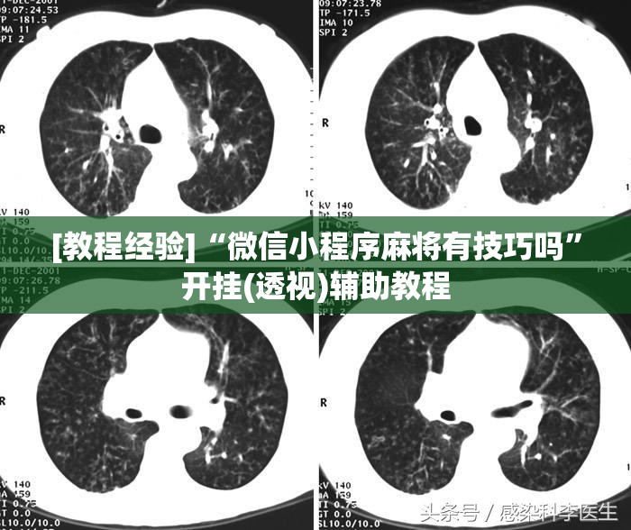 [教程经验]“微信小程序麻将有技巧吗”开挂(透视)辅助教程