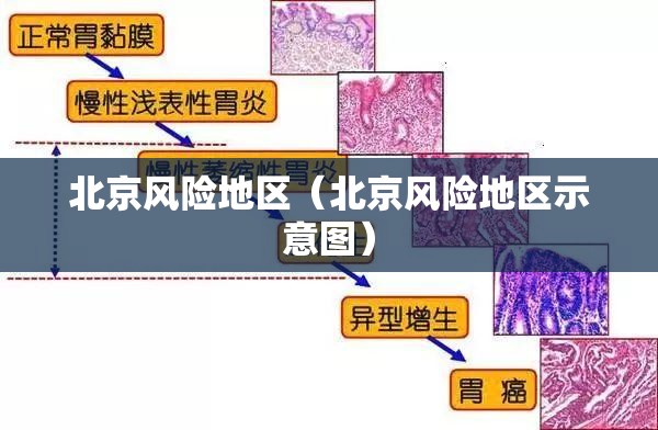 北京风险地区(北京风险地区示意图) 北京风险地区(北京风险地区示意图)