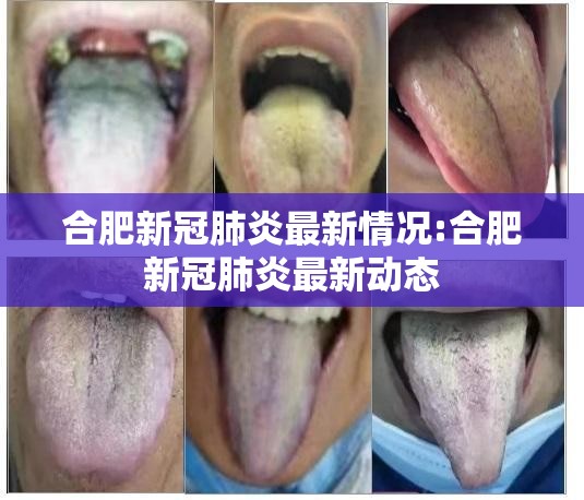 合肥新冠肺炎最新情况:合肥新冠肺炎最新动态 合肥新冠肺炎最新情况:合肥新冠肺炎最新动态