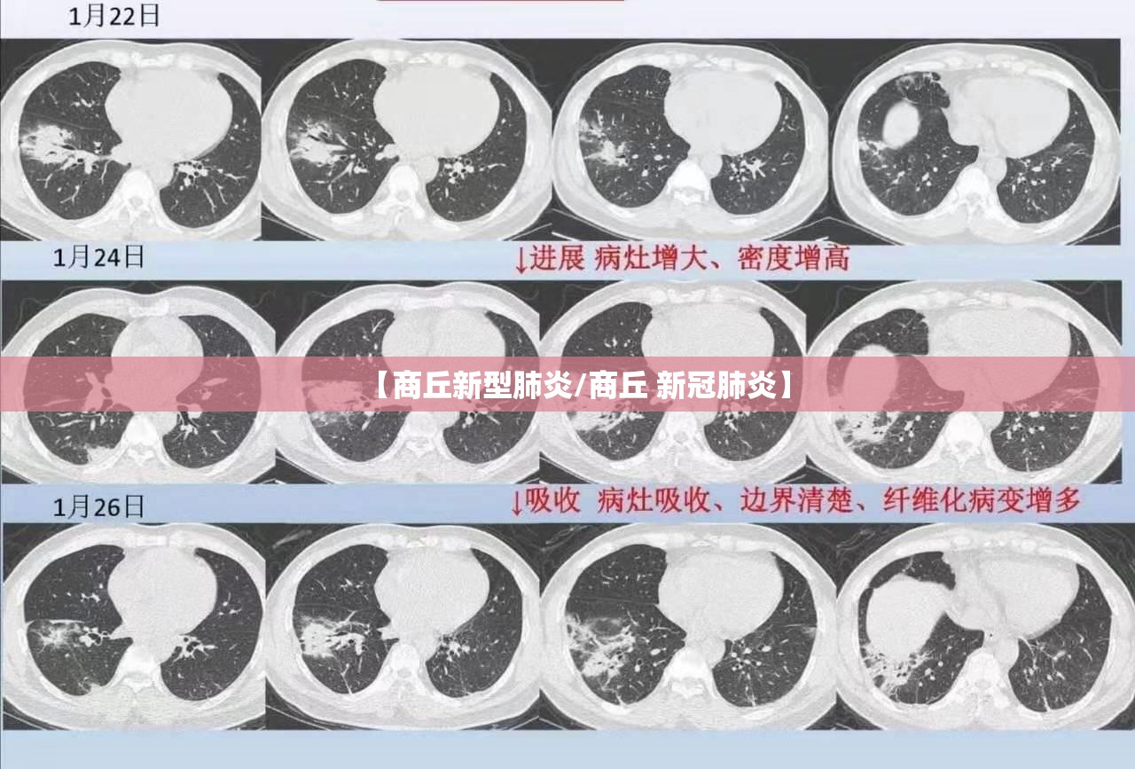 【商丘新型肺炎/商丘 新冠肺炎】