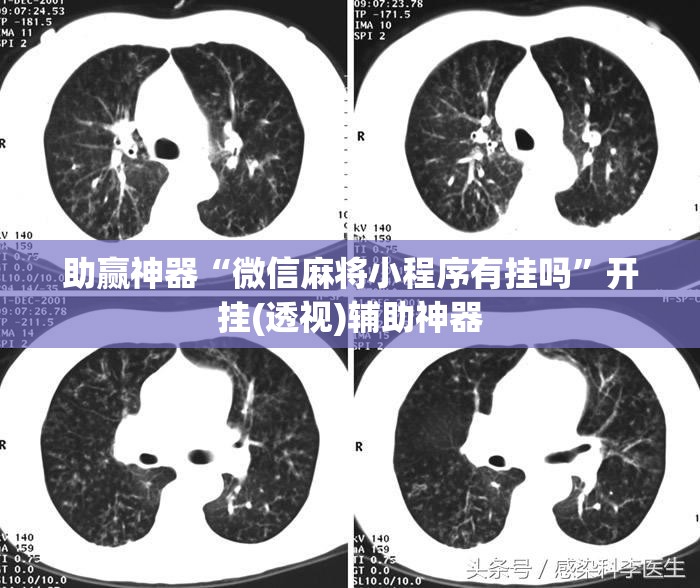 助赢神器“微信麻将小程序有挂吗	”开挂(透视)辅助神器