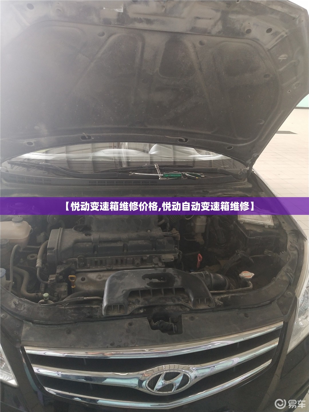 【悦动变速箱维修价格,悦动自动变速箱维修】 【悦动变速箱维修价格,悦动自动变速箱维修】