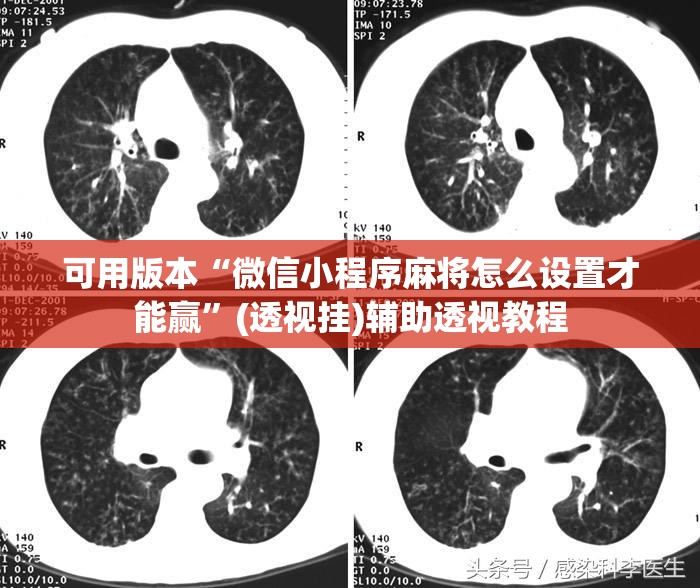 可用版本“微信小程序麻将怎么设置才能赢”(透视挂)辅助透视教程