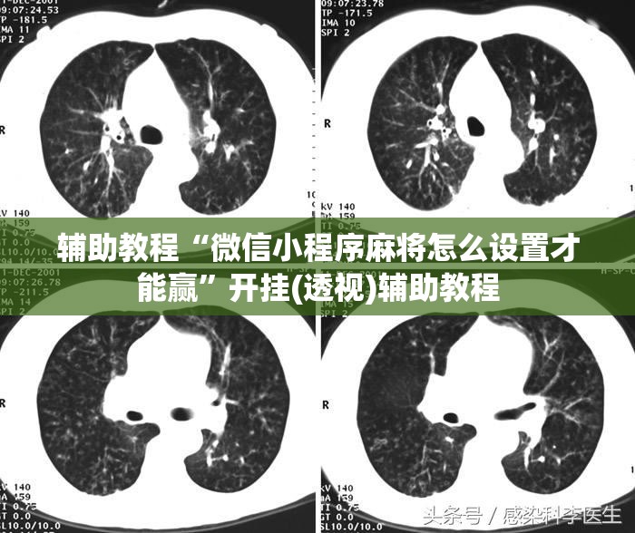 辅助教程“微信小程序麻将怎么设置才能赢	”开挂(透视)辅助教程
