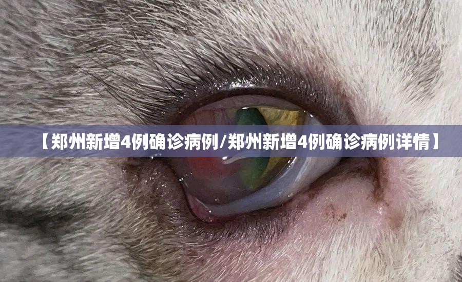【郑州新增4例确诊病例/郑州新增4例确诊病例详情】