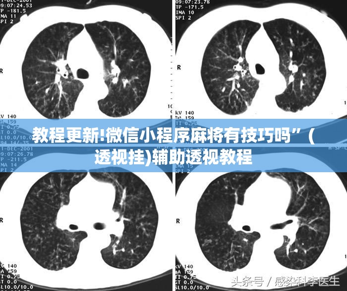 教程更新!微信小程序麻将有技巧吗	”(透视挂)辅助透视教程