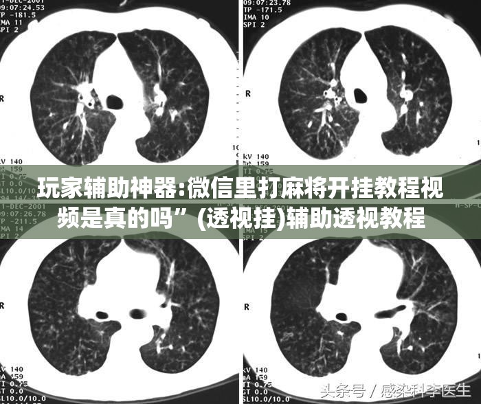 玩家辅助神器:微信里打麻将开挂教程视频是真的吗	”(透视挂)辅助透视教程