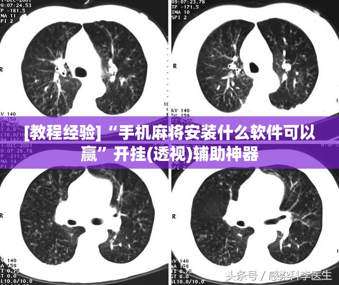 [教程经验]“手机麻将安装什么软件可以赢”开挂(透视)辅助神器