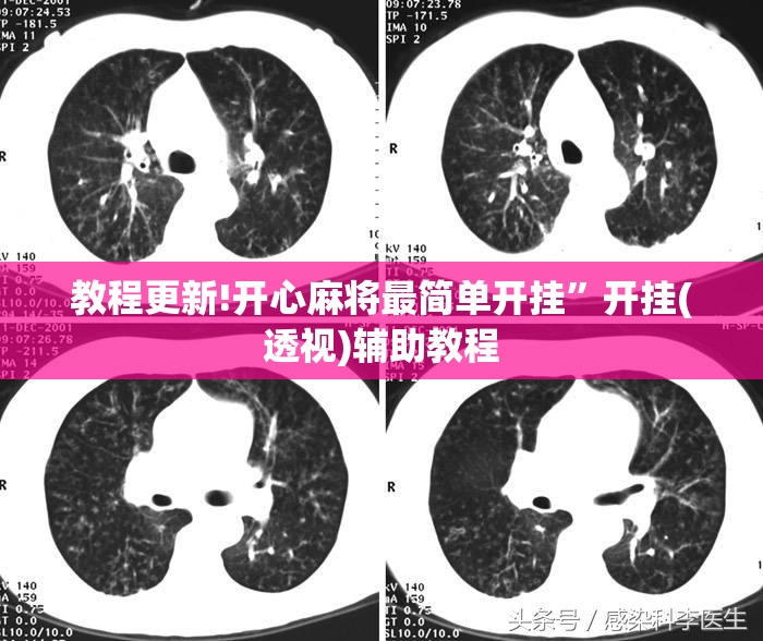 教程更新!开心麻将最简单开挂”开挂(透视)辅助教程