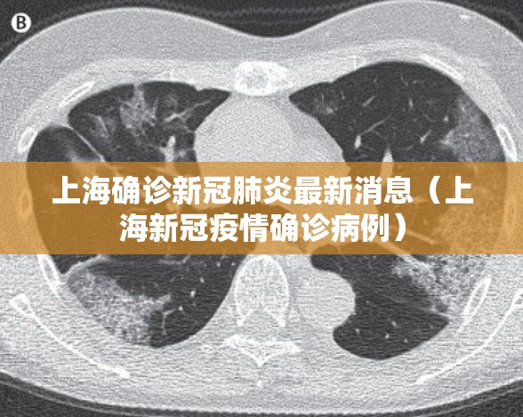 上海确诊新冠肺炎最新消息(上海新冠疫情确诊病例) 上海确诊新冠肺炎最新消息(上海新冠疫情确诊病例)