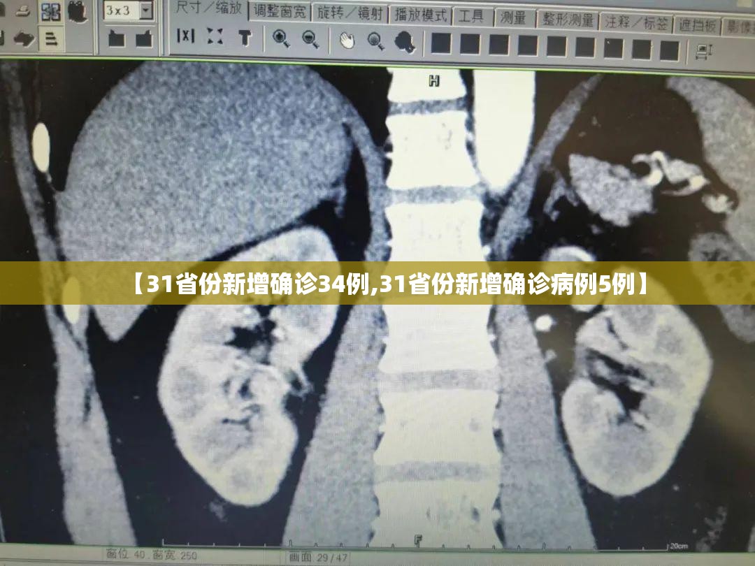 【31省份新增确诊34例,31省份新增确诊病例5例】
