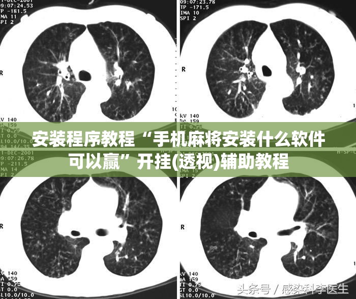 安装程序教程“手机麻将安装什么软件可以赢	”开挂(透视)辅助教程