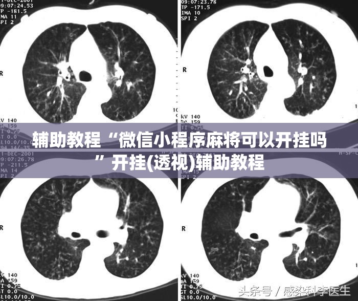 辅助教程“微信小程序麻将可以开挂吗	”开挂(透视)辅助教程