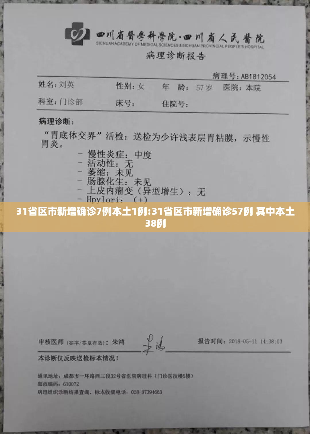 31省区市新增确诊7例本土1例:31省区市新增确诊57例 其中本土38例