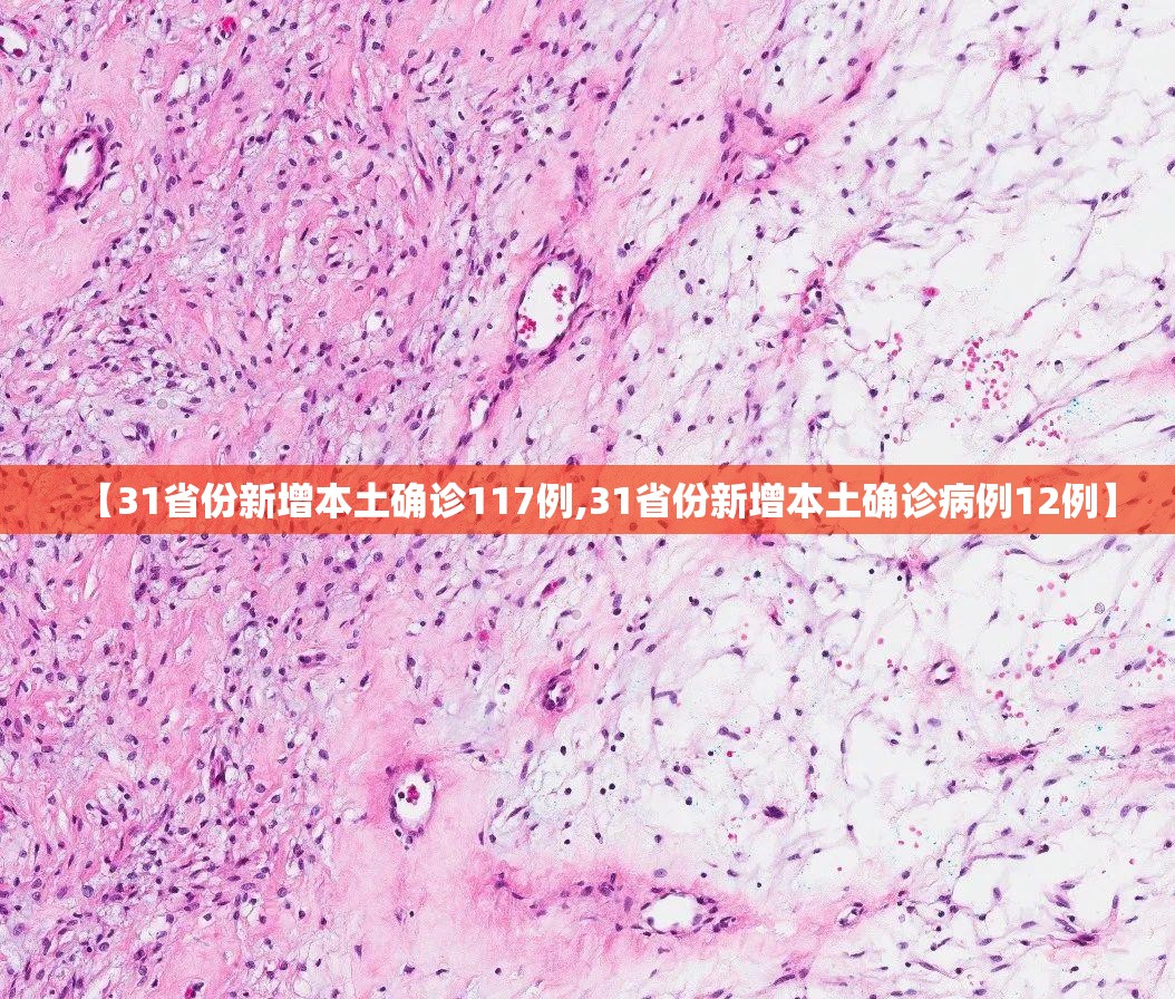【31省份新增本土确诊117例,31省份新增本土确诊病例12例】 【31省份新增本土确诊117例,31省份新增本土确诊病例12例】