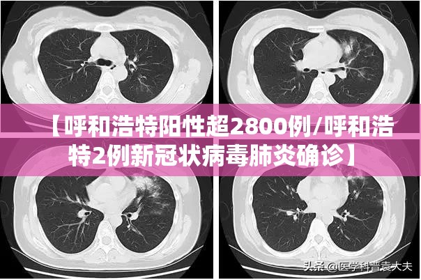 【呼和浩特阳性超2800例/呼和浩特2例新冠状病毒肺炎确诊】